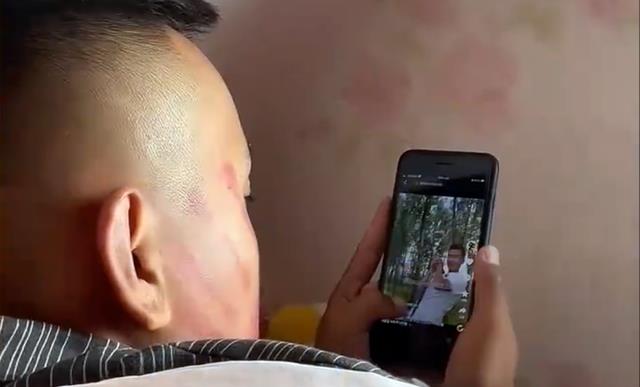 男子躺床上当着老婆面干这事,脸上的红手印成亮点,网友:不过分