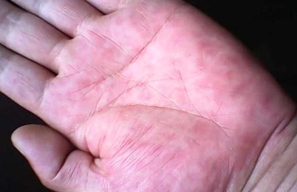 |肝不好能吃玉米吗?医生建议:夏季养肝,4种饮食尽可能不吃