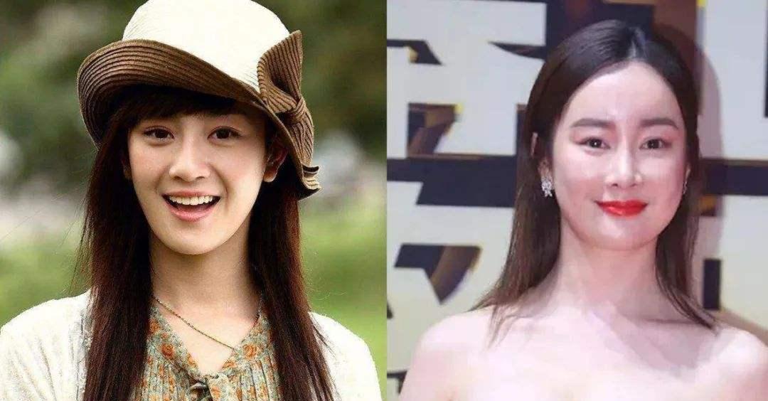 整容|“为爱整容”的张檬，塑料感满满，她都整了哪里呢？