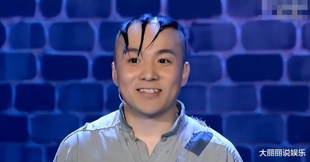 小姐姐|童星“三毛”34岁了!8岁爆火14岁谢顶,植发挨300多针,今成帅哥