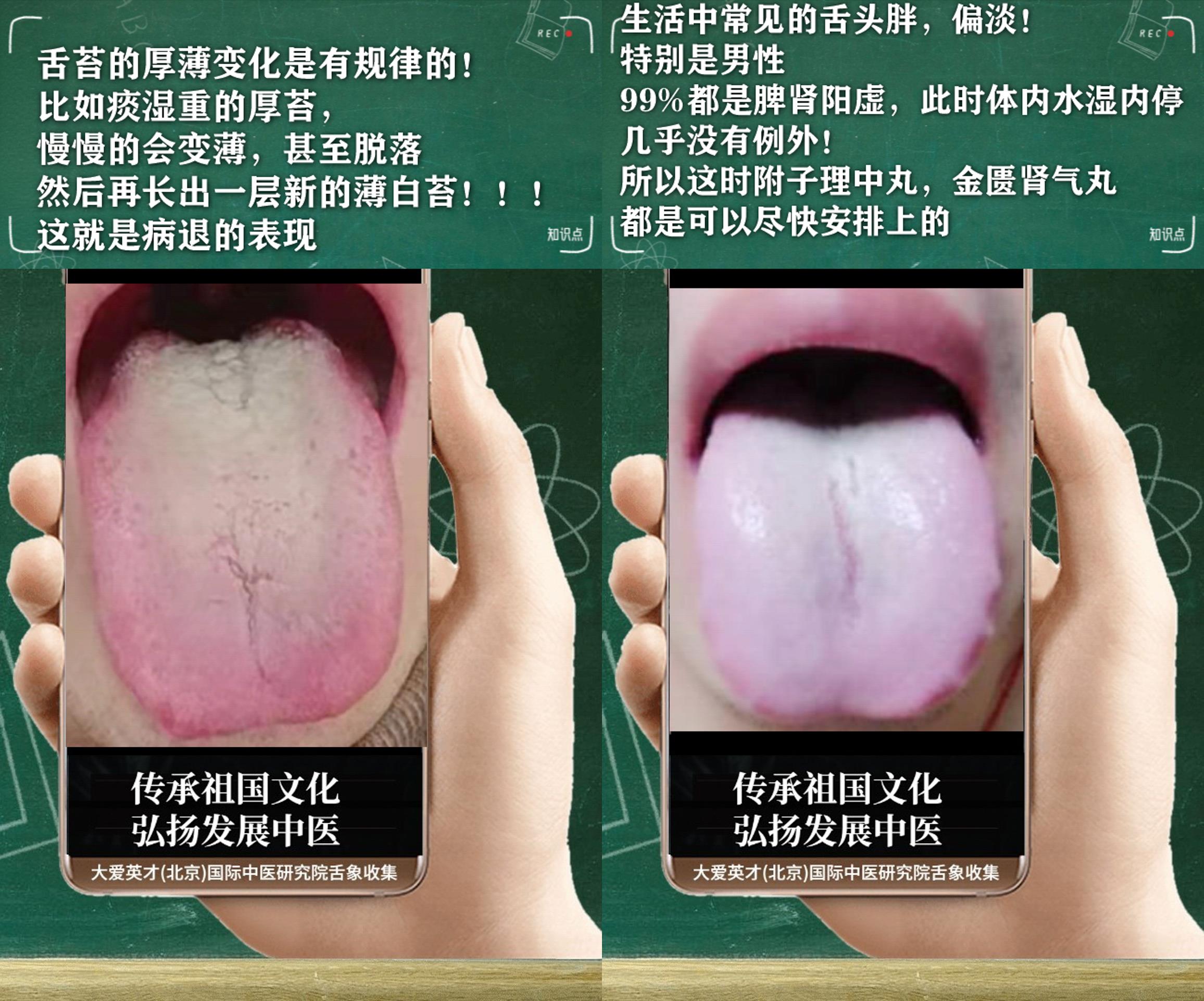 穴位|中医分析:很烦躁,腰膝酸软,鼻子不通,一直反复很烦躁