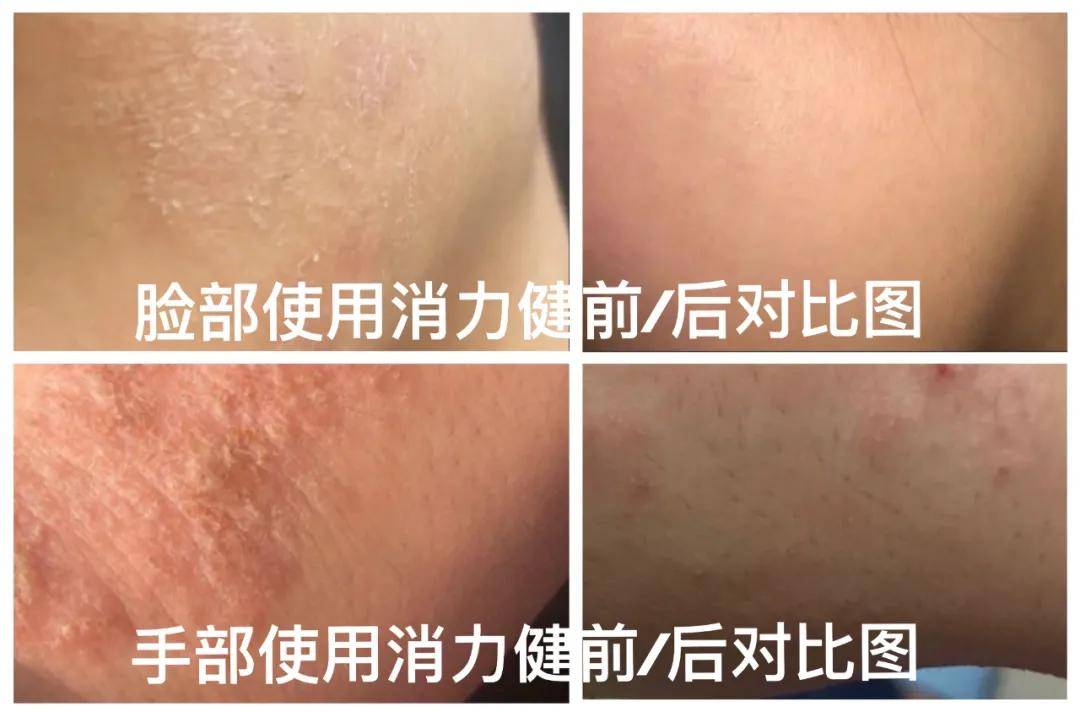 护肤 正确的护肤方式才可以让脸变得更水润光滑