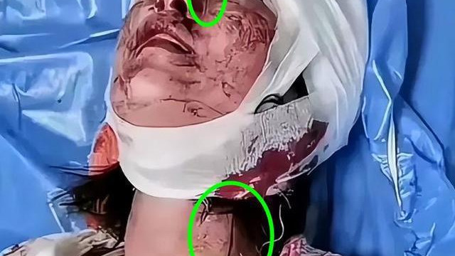 无法想象！唐山涉案黑衣女子与受伤女生住在同一家医院