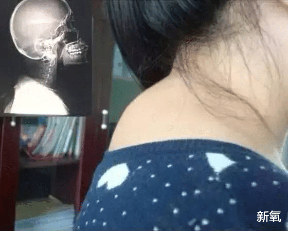 |静态称霸动态拉胯,翻版宋慧乔就这?