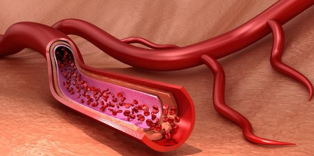 水果|不想被糖尿病并发症“带走”，三招有效预防病症来袭