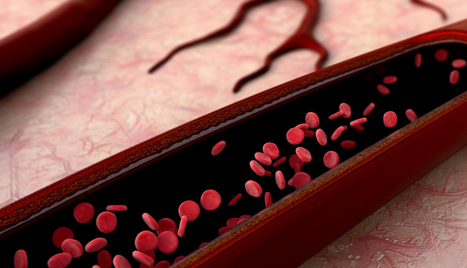 降血脂|喝柠檬水能降血脂？医生：3种水是天然“他汀”，你若爱喝，血脂蹭蹭降