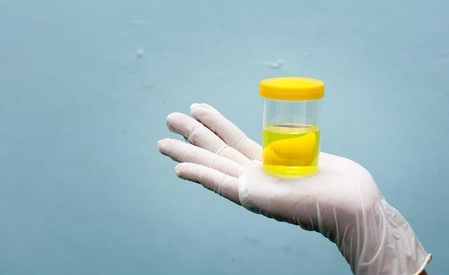 牛奶|长期尿蛋白对身体有什么影响?