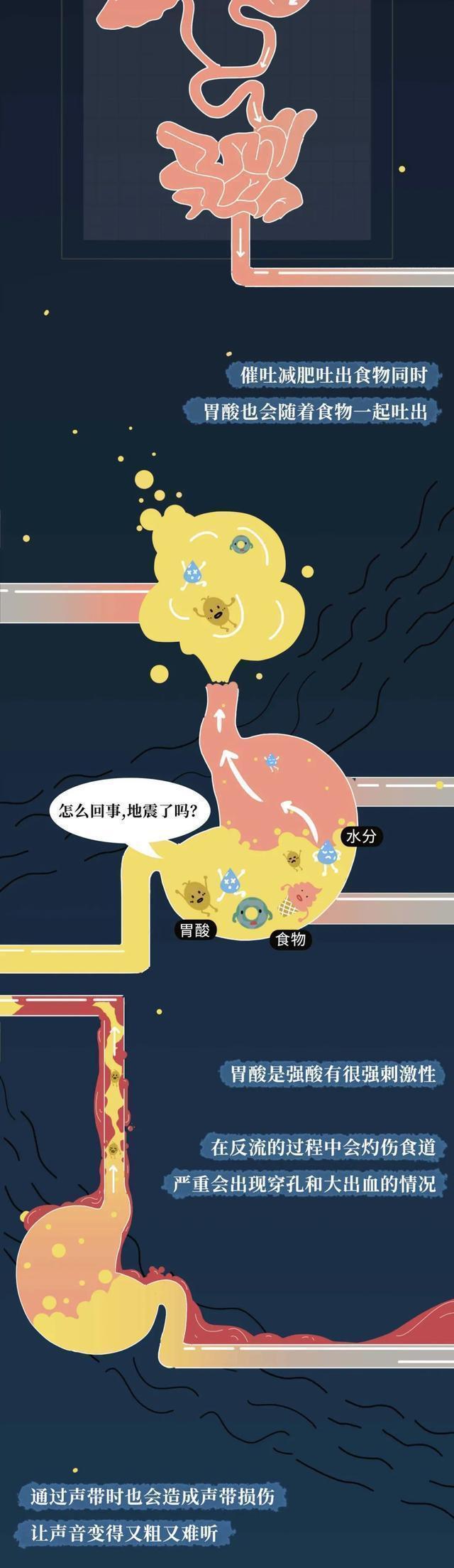 那些把“仙女管”插入体内的女生，是怎么想的？难道不考虑后果吗