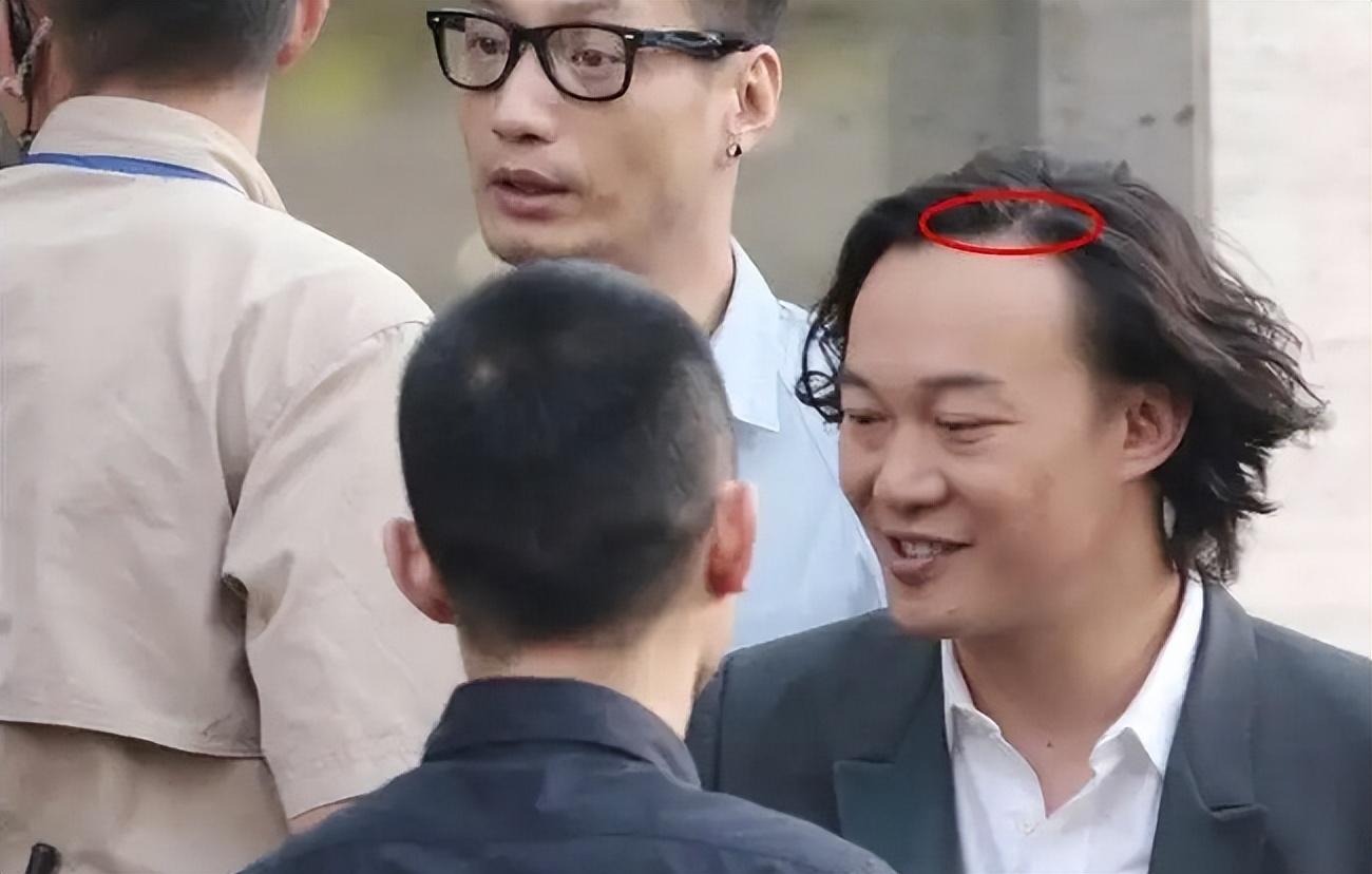 沙溢|看似帅气,实则脱发严重!沙溢、彭于晏、白敬亭......心酸又好笑