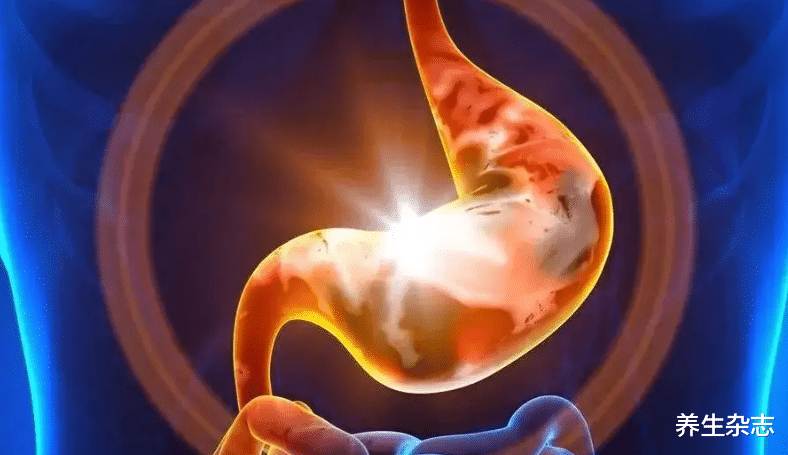 失眠|一天一个红薯,60岁独居老人胃癌离世,医生:无知,或是在“自毁胃”