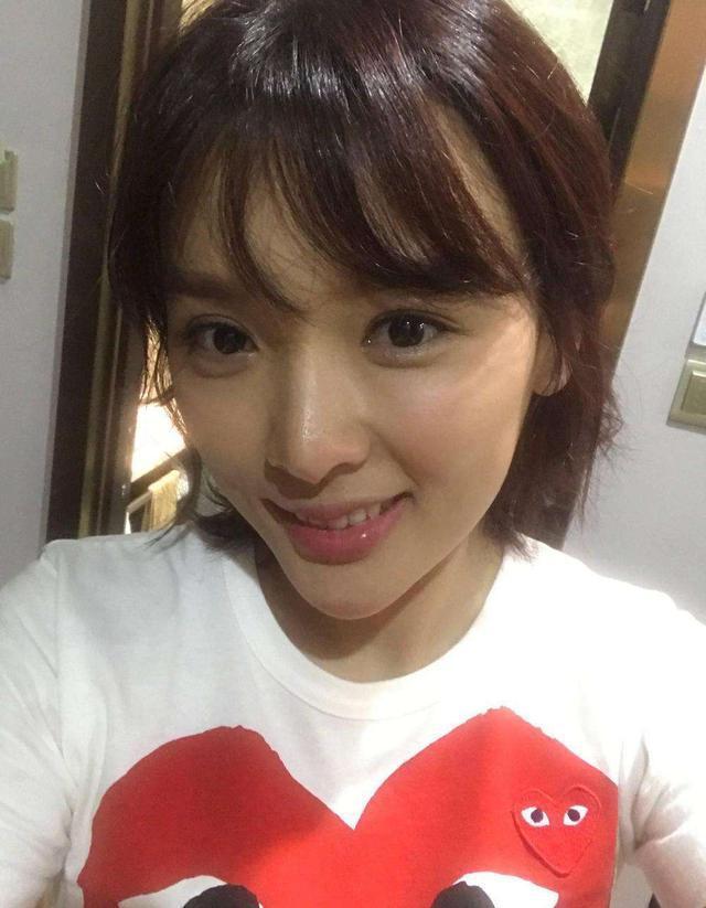 整容|赵本山女徒弟“香秀”，因整容失败影响演戏，称维权索赔很艰难