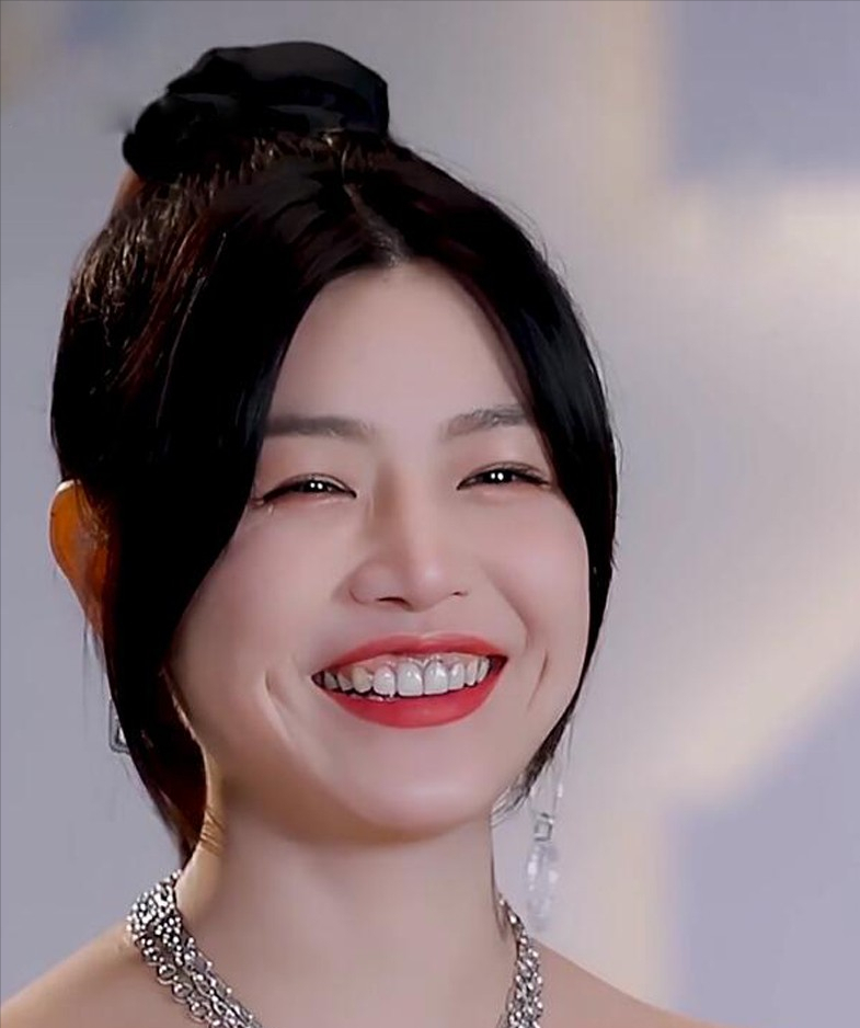 娱乐圈|瞅瞅娱乐圈这清一色的烤瓷牙,上头~