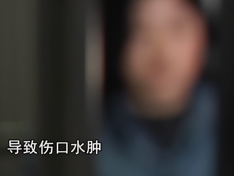 按摩|从2000元的切皮手术，到14万的医疗费，他一进去就被套路了