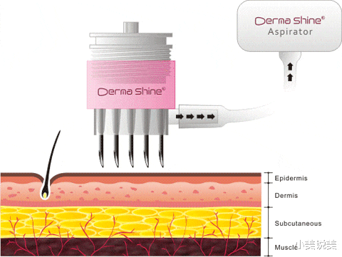 香蕉 好好的皮肤为啥这么暗淡?怎么解决肌肤暗沉?
