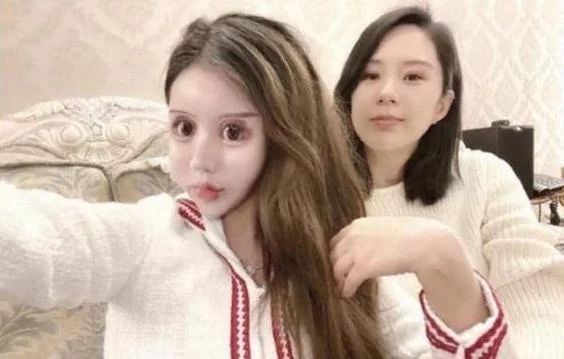 岳云鹏|还记得13岁开始整容,花费上百万整容60次的女孩吗?现状令人唏嘘