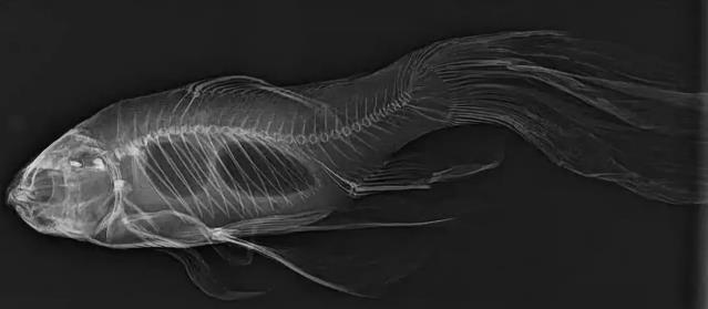 肺癌|盘点30张奇奇怪怪的X光片，看完整个人都不好了！