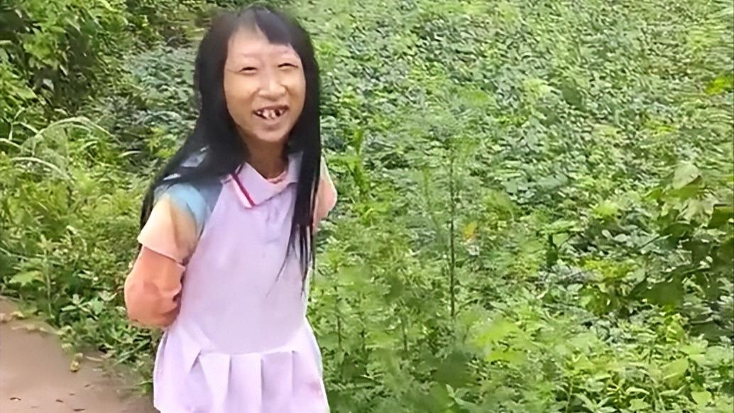 袖珍人小晓34岁体重26斤，从被可怜到全网谩骂，她究竟做了什么