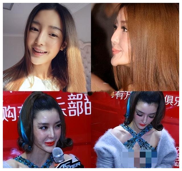 明星|明星整脸有多拼？“一刀切”说做就做，有女星因后遗症影响一生