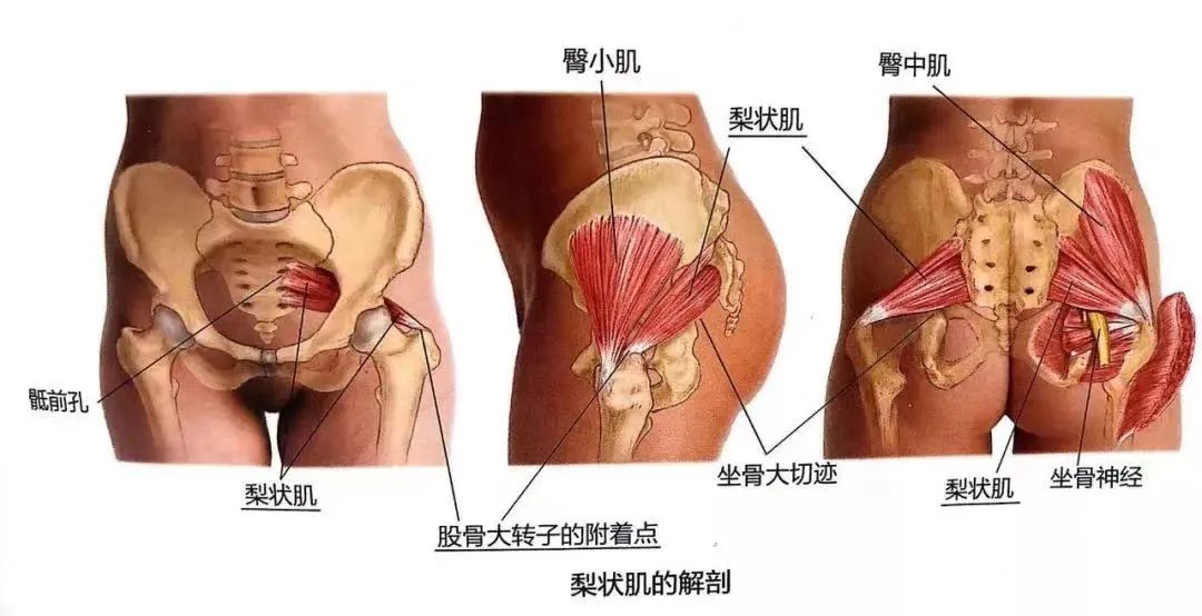 肝脏|臀部酸麻胀痛？你的梨状肌可能损伤了！这几个动作帮你摆脱苦恼！
