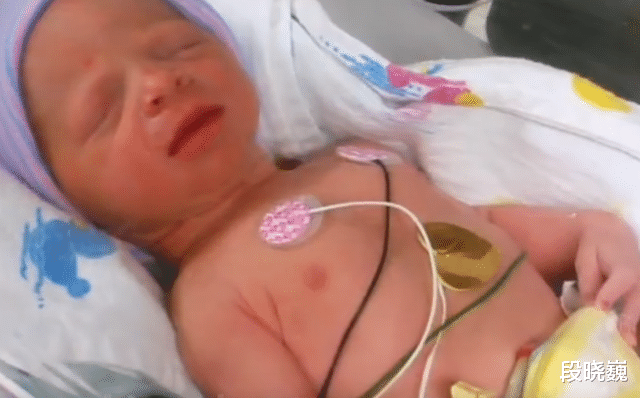 尿蛋白|25岁女孩体重600斤，瘦成闪电却遭丈夫背叛，丈夫：我喜欢胖子