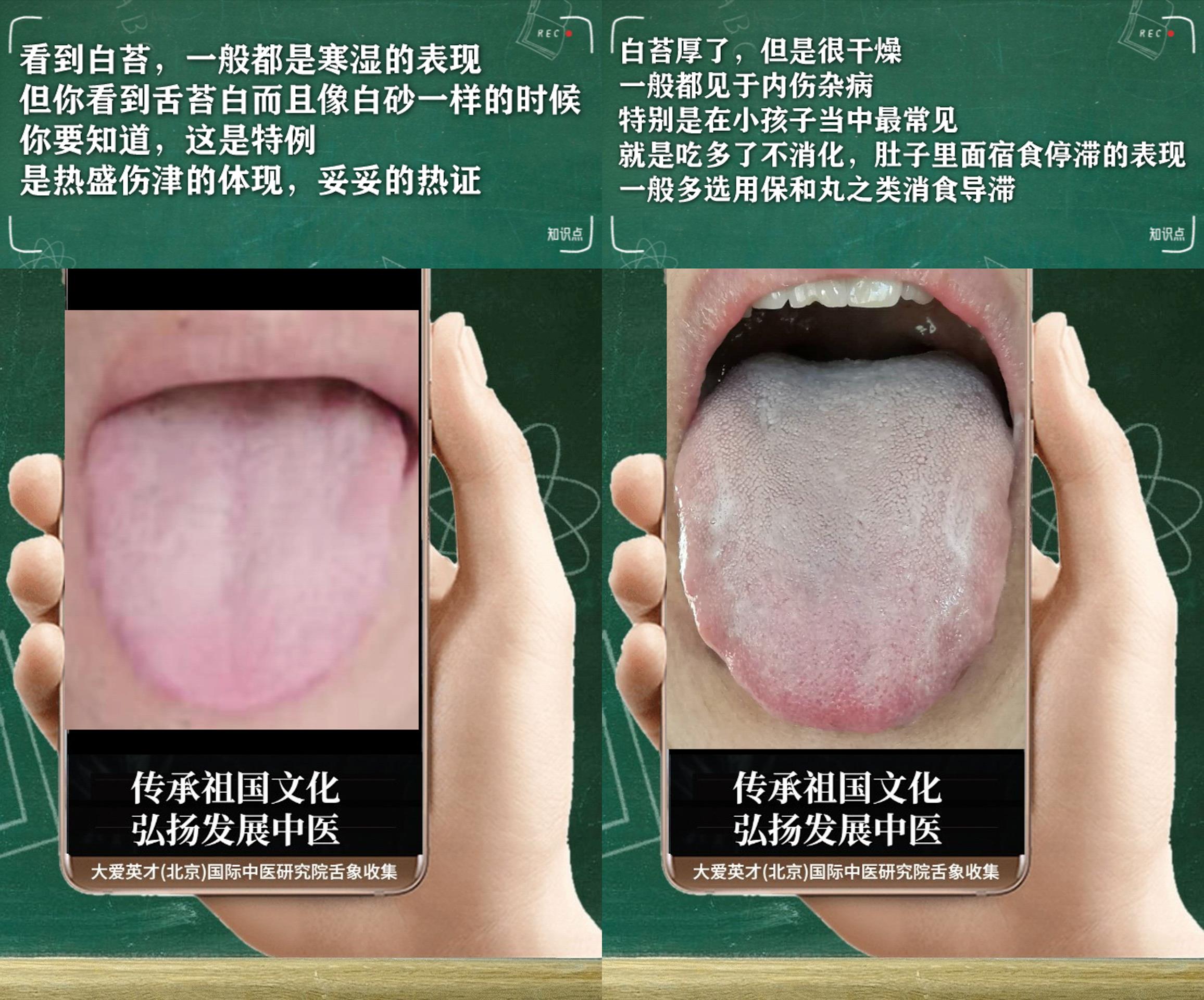 腹泻|中医医案:总是胃痛,胃胀气,食欲不振,排便困难,脾虚肝郁