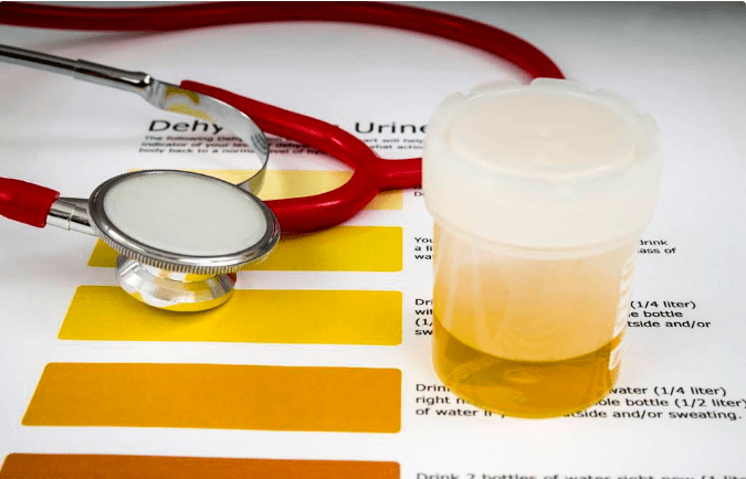 经络|肾病想要降尿蛋白有效，还有先控制好这2点，事半功倍