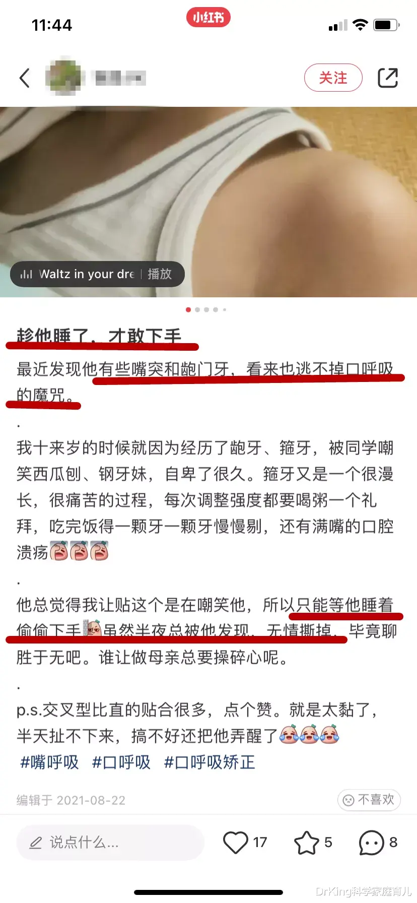 月销10万＋的口呼吸贴，别再给娃用了！背后的隐患医生都捏把汗
