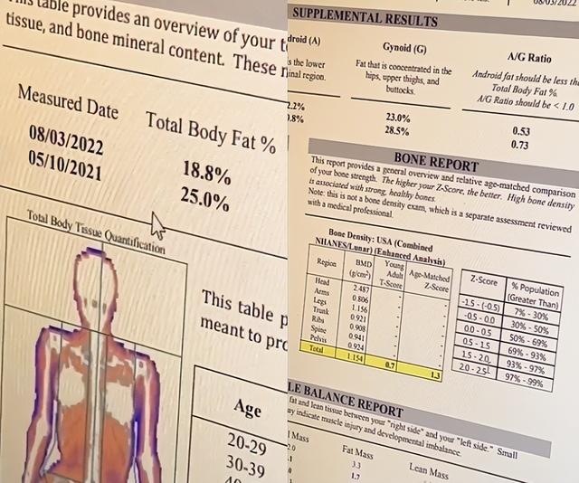 金·卡戴珊|金卡戴珊晒体检报告!多次整形致身材变形,直言:比很多人都强壮