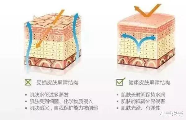 美肤医师郭金月：想要皮肤水嫩，该选择光子嫩肤还是水光？