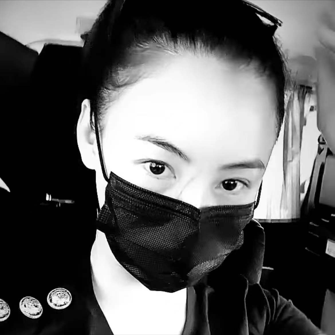 张柏芝|张柏芝被3岁小儿子抓伤脸部，伤口较长且深像刀疤一样遮都遮不住