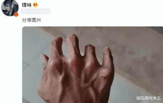 谢霆锋|谢霆锋分手风波后现身家庭聚会，近照憔悴落寞，身形消瘦手全是伤