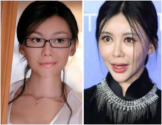 整容|7位被整容毁了的明星,有人美丽尽失事业滑坡,有人甚至赔了性命