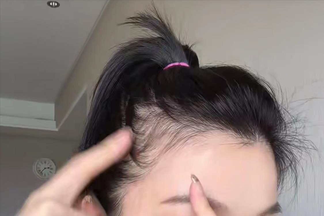 发饰 修饰发际线及鬓角的小脸秘诀,夏天扎马尾盘头发也不怕