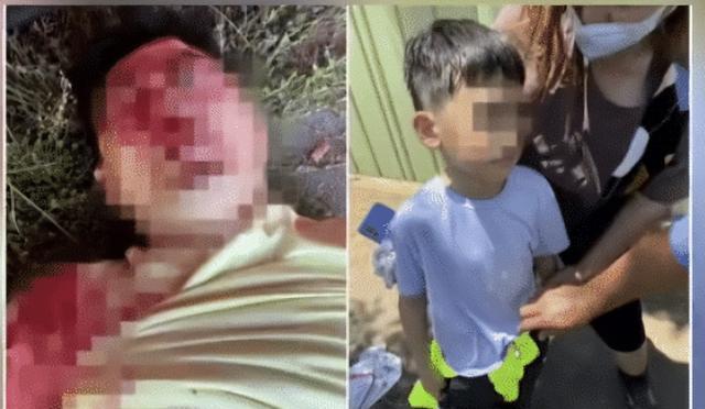 林志颖|这就是脸部3D重建?网友:看着都肉疼,林志颖得忍受多大的痛苦啊!