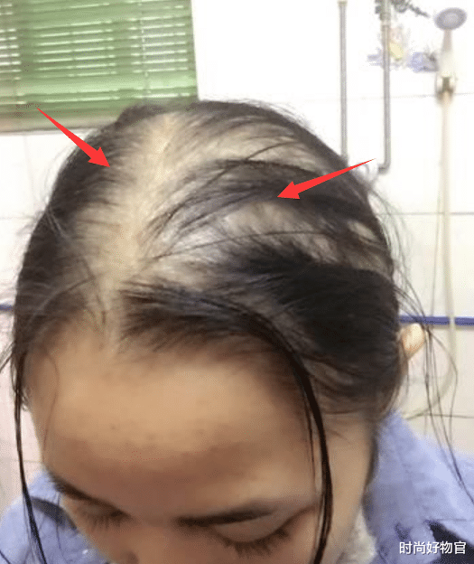 洗发水|被列入“黑名单”的3款洗发水,或会致“掉发严重”,学生党:扔了