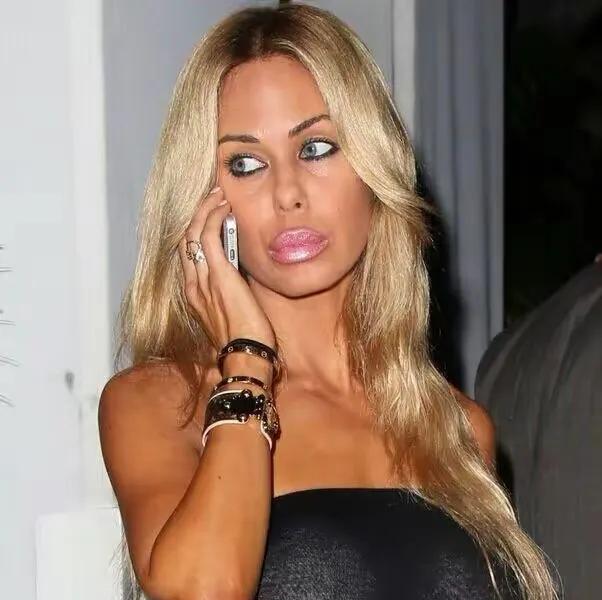 短发 Jessi厚唇被骂怪物、辛芷蕾三瓣唇、肯豆唇肿似蜂蛰,填充失败?