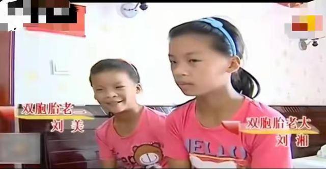 母亲怀孕吃打胎药,致使双胞胎儿子变成双胞胎女儿