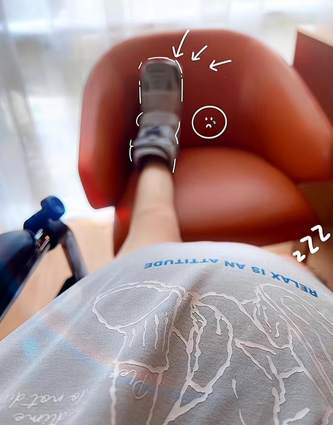 戚薇|戚薇二胎产后露面，因崴脚导致月子全程坐轮椅，努力减肥月瘦15斤