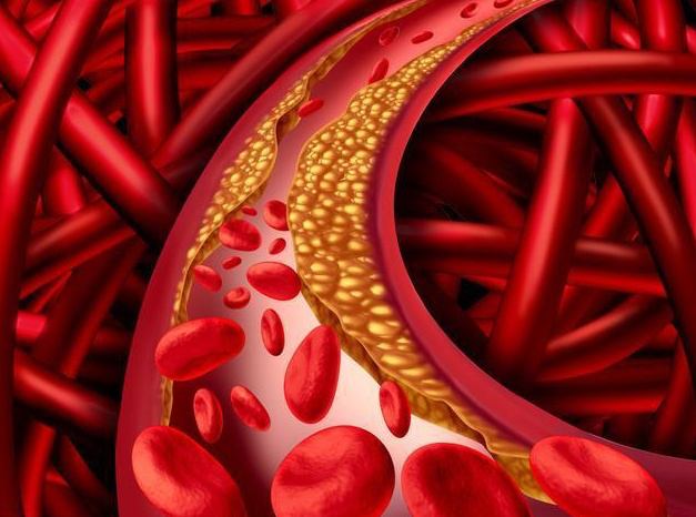 肾病|尿液泡沫多是肾病预兆?出现3种情况要警惕肾功能衰竭