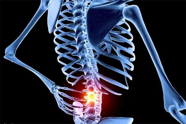 失眠|腰椎间盘突出能受凉吗？患者要注重保暖