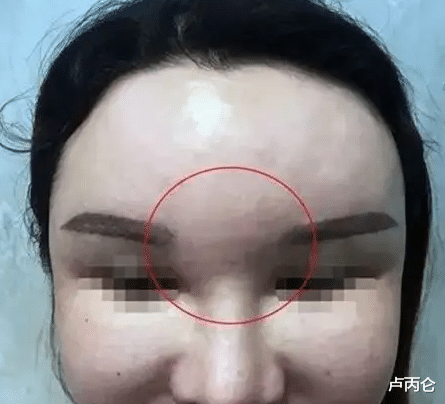 肾结石|生长因子这种外用涂抹药品，求求美容院别再注射害人了