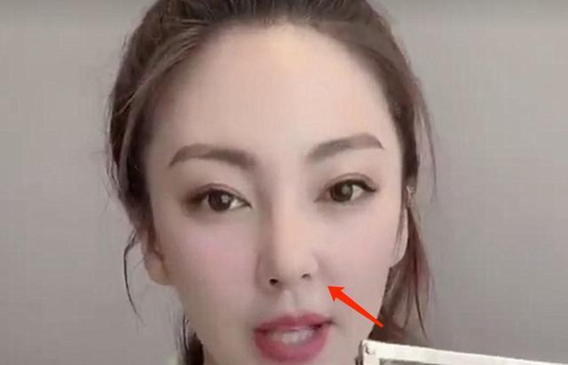 张雨绮|隆过鼻子的十位明星,张雨绮鼻梁变宽,毛晓彤很自然