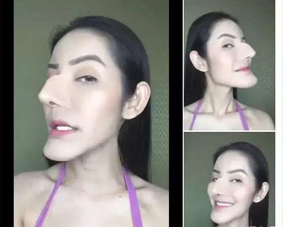 整容|泰国网红，花费百万把自己整成了老巫婆，看起来有些吓人