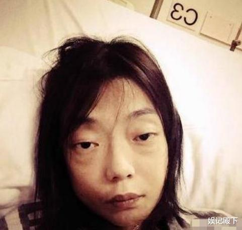 她艳绝香港,因丈夫一句话全身瘫痪似骷髅,牙肉腐蚀脱落惨遭抛弃