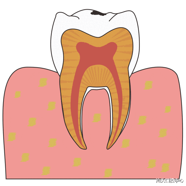 白萝卜|早上起床,应该先刷牙还是先吃饭?