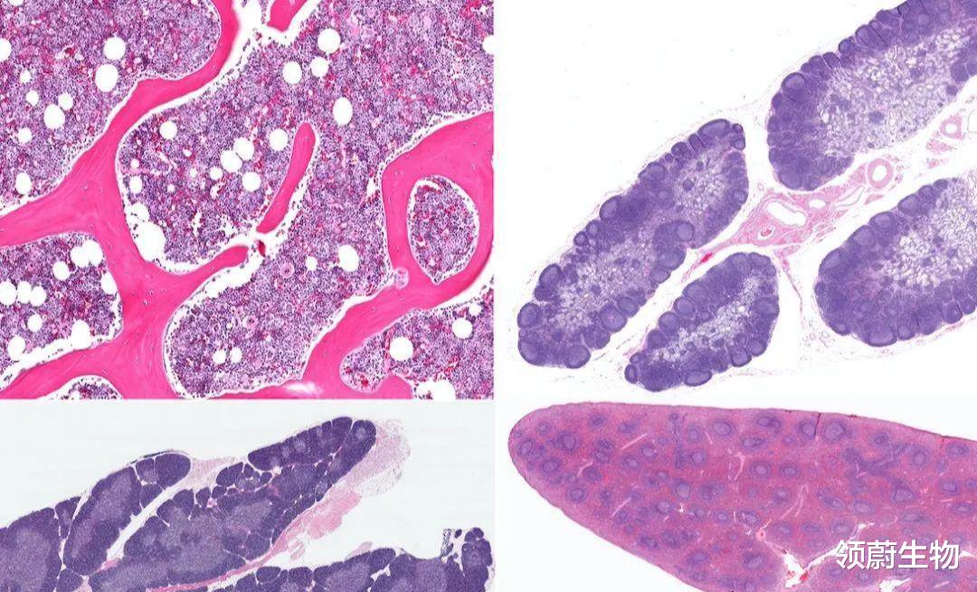 饮食|干细胞移植有望摆脱肾透析,肾衰不再别无选择