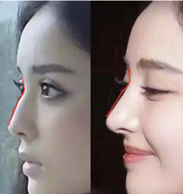 明星|这些明星们的假鼻子，绝了！都是狠人