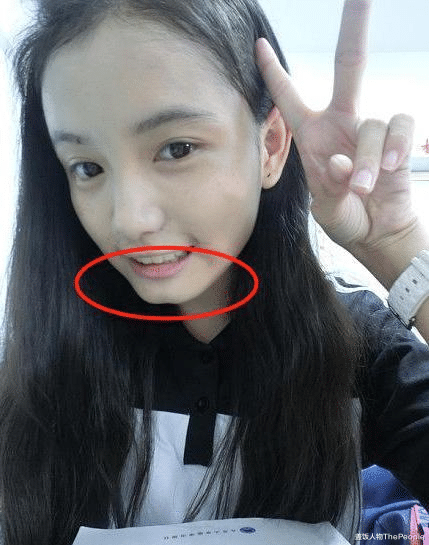 林青霞|美人沟下巴有多好看？林青霞下巴凹陷成经典，戚薇变尖却失辨识度