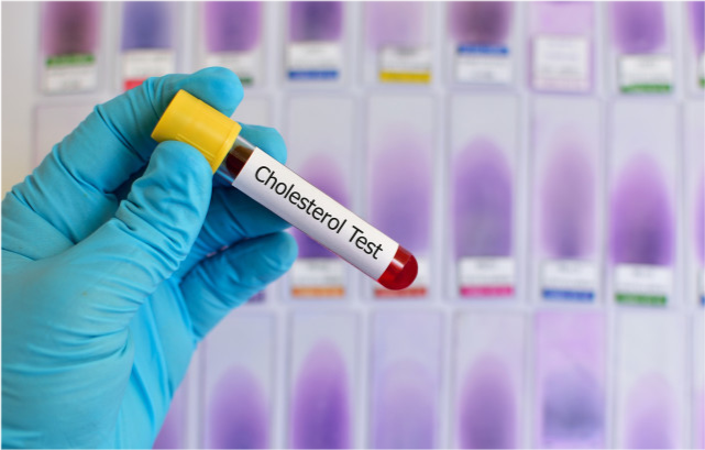 饮食|为什么血脂高的人,需要忌酒?肉和油也不能吃吗?看下专业的解答