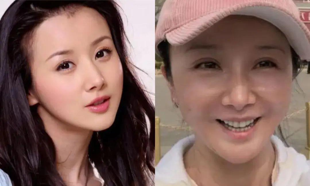 杨幂|女星“削骨”后遗症：杨幂变多边形脸，鞠婧祎脸歪，孙菲菲脸尖